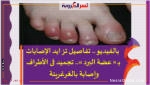 عوامل الخطورة: عضة الصقيع