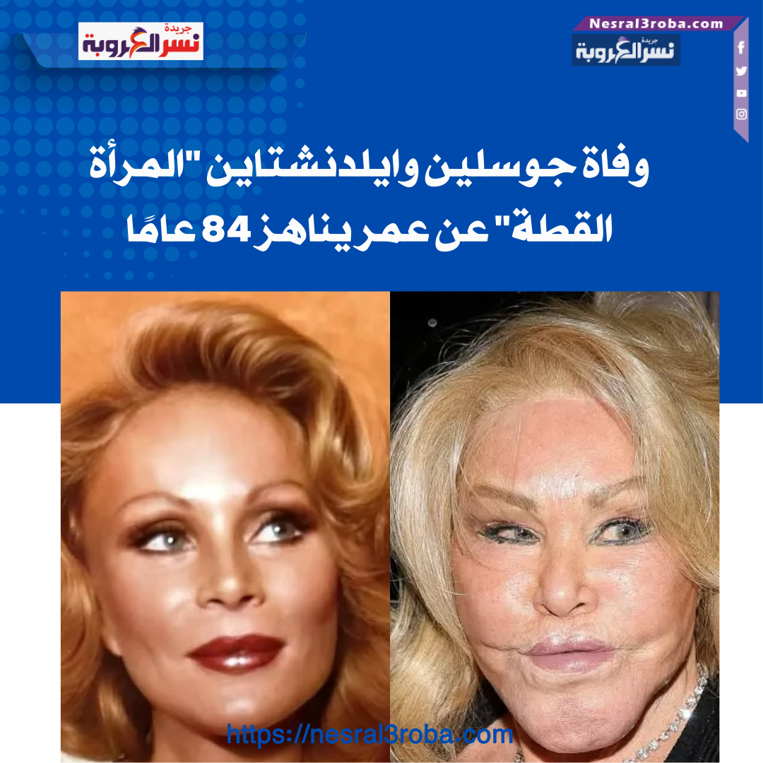 وفاة جوسلين وايلدنشتاين "المرأة القطة" عن عمر يناهز 84 عامًا