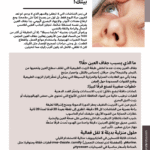 👁️✨ جفاف العين بين الطب والتجميل: راحة ونضارة تبدأ من بيتك!