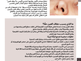 👁️✨ جفاف العين بين الطب والتجميل: راحة ونضارة تبدأ من بيتك!