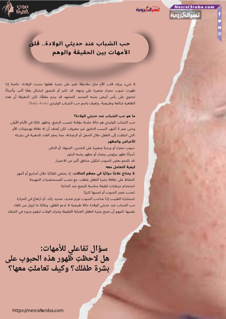 حب الشباب عند حديثي الولادة.. قلق الأمهات بين الحقيقة والوهم