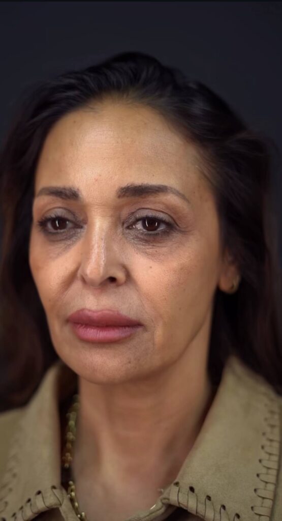 624717258 912142668043194 7495446279560779555 n