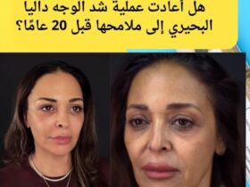 ل نجحت داليا البحيري في استعادة ملامحها القديمة بعملية تجميل واحدة؟