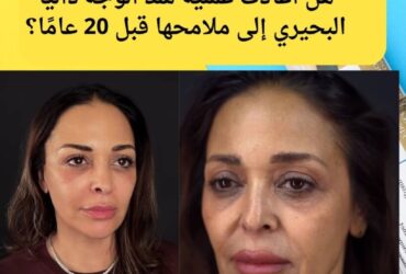 ل نجحت داليا البحيري في استعادة ملامحها القديمة بعملية تجميل واحدة؟