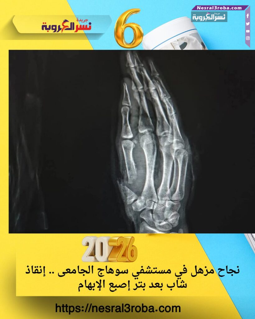 نجاح مزهل في مستشفي سوهاج الجامعى .. إنقاذ شاب بعد بتر إصبع الإبهام