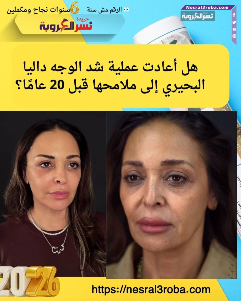 ل نجحت داليا البحيري في استعادة ملامحها القديمة بعملية تجميل واحدة؟